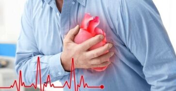 Rối loạn nhịp tim là gì